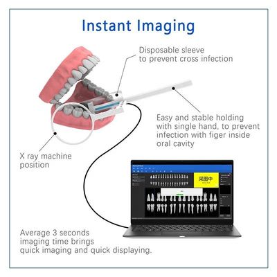 Máy nha khoa X Ray đa năng USB, Thiết bị X Ray nha khoa cầm tay không dây