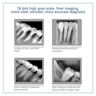 Máy nha khoa X Ray đa năng USB, Thiết bị X Ray nha khoa cầm tay không dây