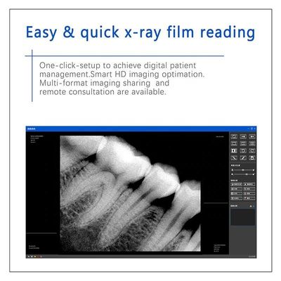 Máy nha khoa X Ray đa năng USB, Thiết bị X Ray nha khoa cầm tay không dây