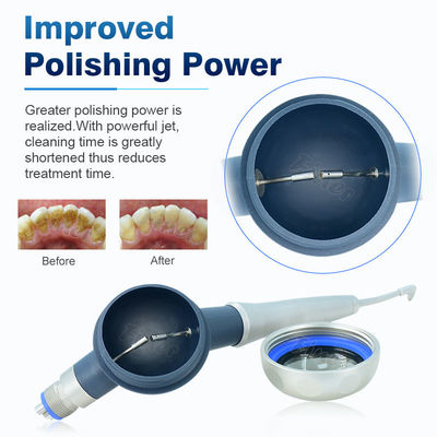 65dB Nha khoa Air Prophy Làm sạch răng Làm trắng Airpolishing Hệ thống đánh bóng răng chạy bằng không khí